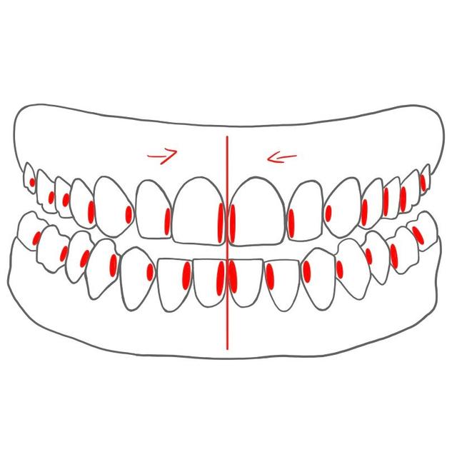 mesial (m)   =   zur Zahnbogenmitte hin

- alle Zähne / Kiefer